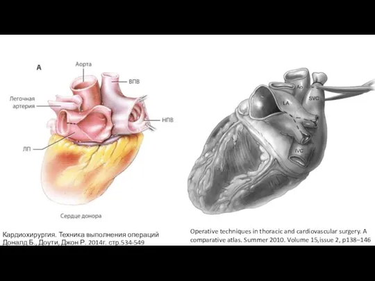 Operative techniques in thoracic and cardiovascular surgery. A comparative atlas. Summer 2010.