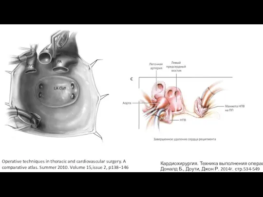 Operative techniques in thoracic and cardiovascular surgery. A comparative atlas. Summer 2010.