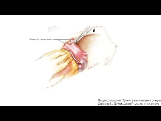 Кардиохирургия. Техника выполнения операций Доналд Б., Доути, Джон Р. 2014г. стр.534-549 6