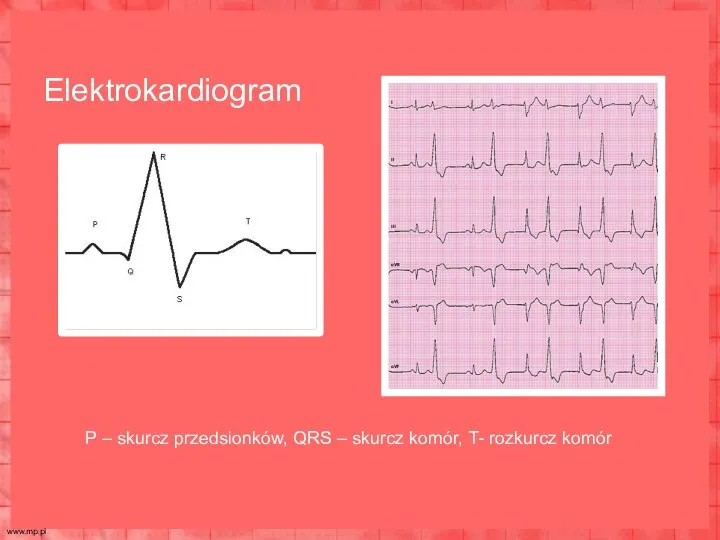 P – skurcz przedsionków, QRS – skurcz komór, T- rozkurcz komór Elektrokardiogram www.mp.pl