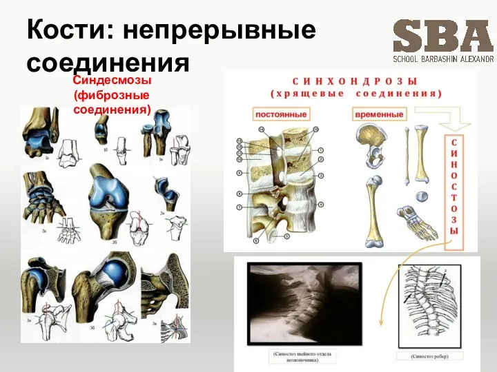 Кости: непрерывные соединения Синдесмозы (фиброзные соединения)