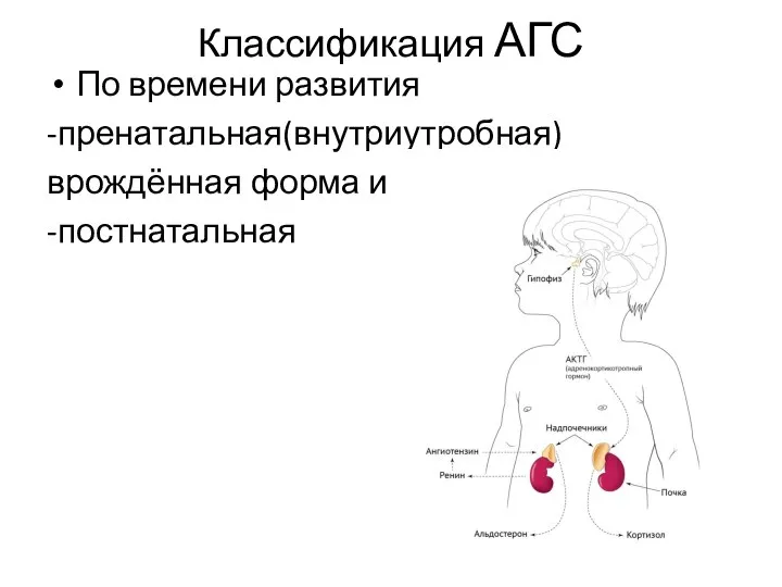 Классификация АГС По времени развития -пренатальная(внутриутробная) врождённая форма и -постнатальная