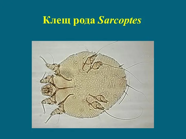 Клещ рода Sarcoptes