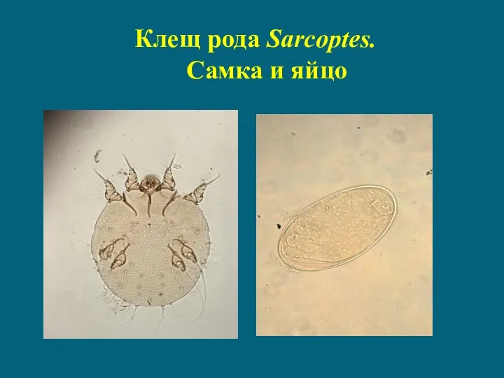 Клещ рода Sarcoptes. Самка и яйцо