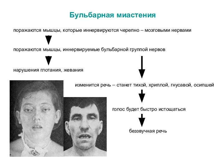 Бульбарная миастения поражаются мышцы, которые иннервируются черепно – мозговыми нервами поражаются мышцы,