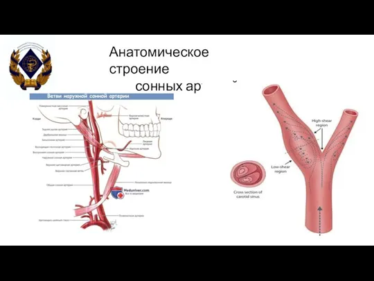 Анатомическое строение сонных артерий