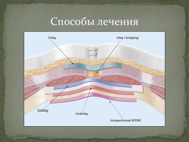 Способы лечения