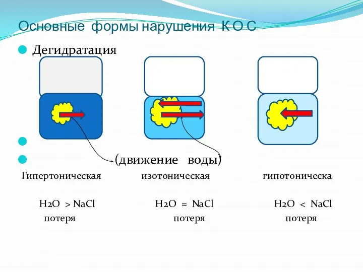 Основные формы нарушения К О С Дегидратация (движение воды) Гипертоническая изотоническая гипотоническа