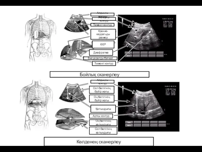 Алдыңғы контур Жоғарғы контур Төменгі контур Кранио-каудальды размер Висцералды беткей ККР Диафрагма