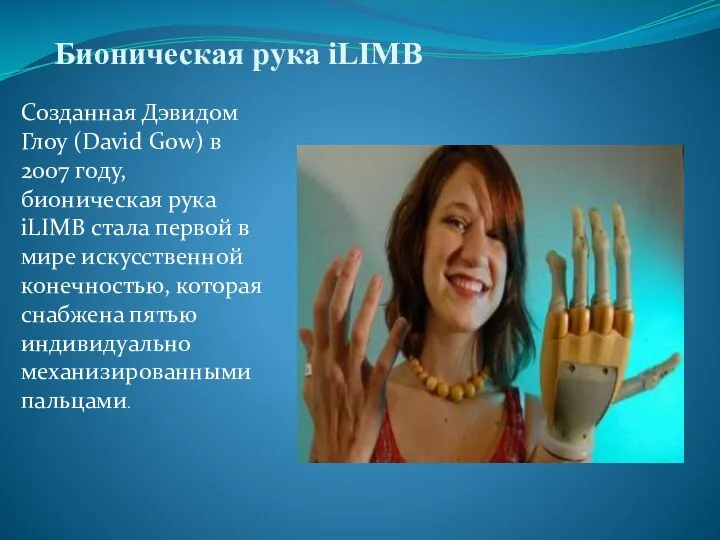 Бионическая рука iLIMB Созданная Дэвидом Глоу (David Gow) в 2007 году, бионическая