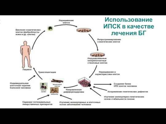 Использование ИПСК в качестве лечения БГ