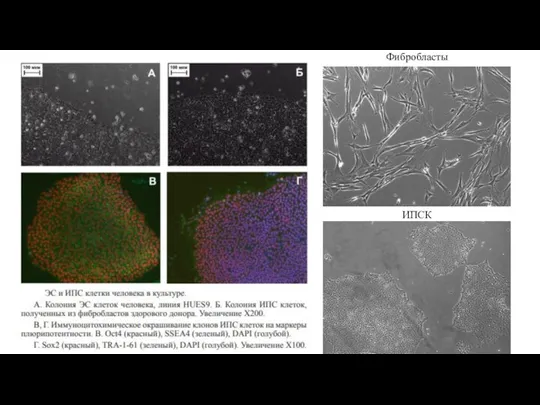 Фибробласты ИПСК