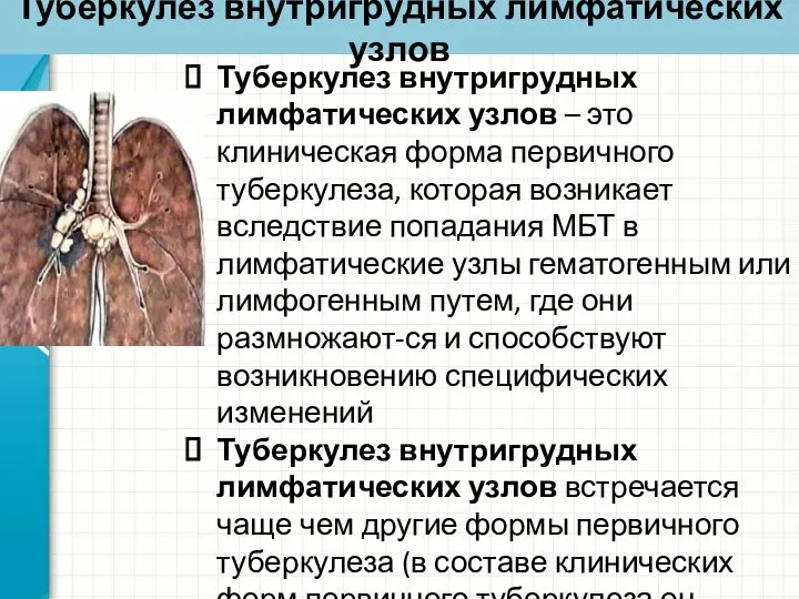 Туберкулез внутригрудных лимфатических узлов Туберкулез внутригрудных лимфатических узлов – это клиническая форма