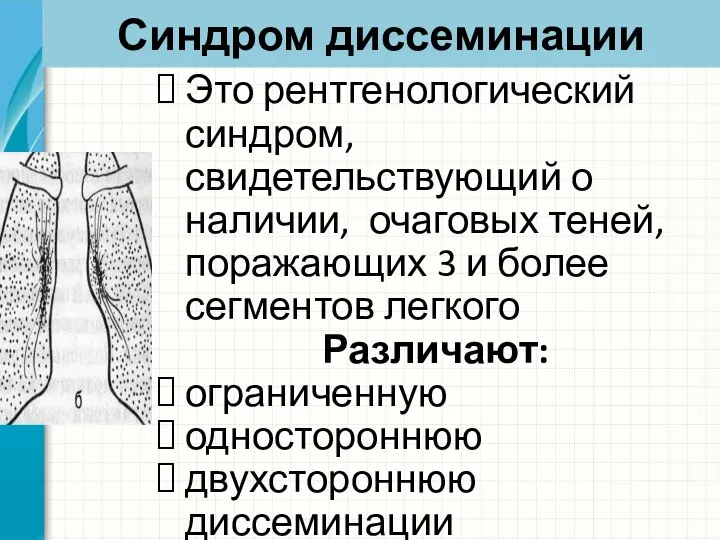 Синдром диссеминации Это рентгенологический синдром, свидетельствующий о наличии, очаговых теней, поражающих 3