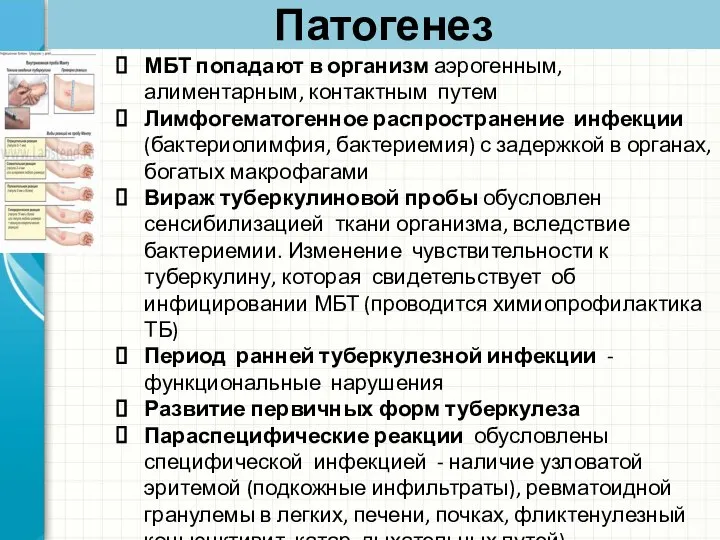 Патогенез МБТ попадают в организм аэрогенным, алиментарным, контактным путем Лимфогематогенное распространение инфекции