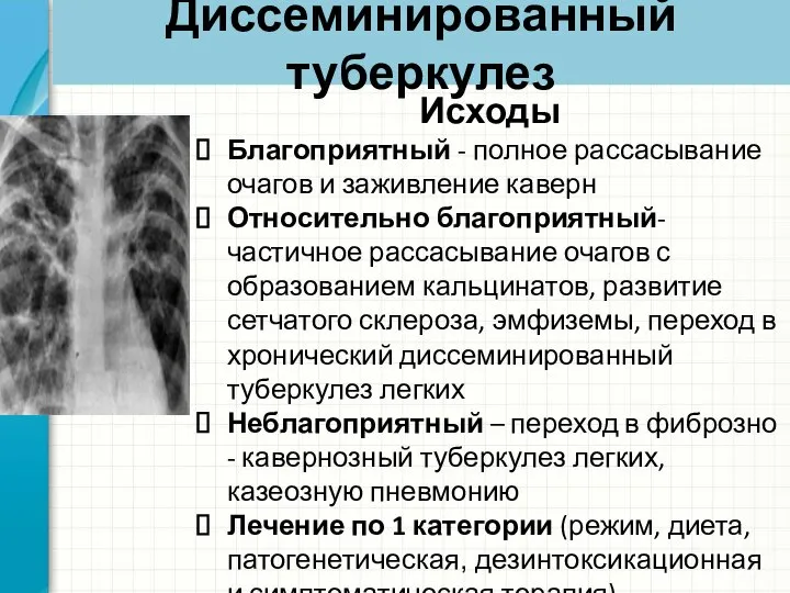 Диссеминированный туберкулез Исходы Благоприятный - полное рассасывание очагов и заживление каверн Относительно