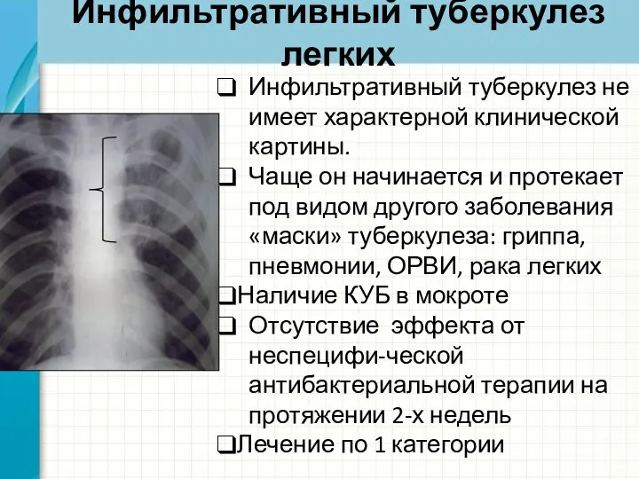 Инфильтративный туберкулез легких Инфильтративный туберкулез не имеет характерной клинической картины. Чаще он