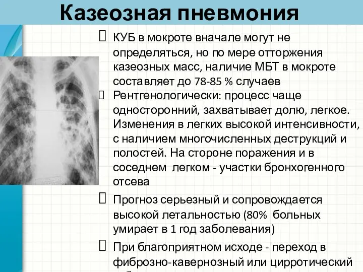 Казеозная пневмония КУБ в мокроте вначале могут не определяться, но по мере