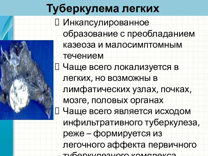 Туберкулема легких Инкапсулированное образование с преобладанием казеоза и малосимптомным течением Чаще всего