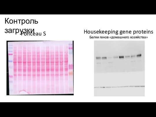 Контроль загрузки Ponceau S Housekeeping gene proteins Белки генов «домашнего хозяйства»