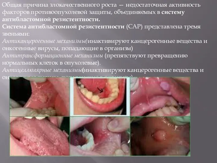 Общая причина злокачественного роста — недостаточная активность факторов противоопухолевой защиты, объединяемых в