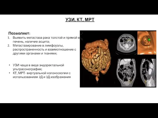 УЗИ, КТ, МРТ Позволяет: Выявить метастаза рака толстой и прямой в печень,