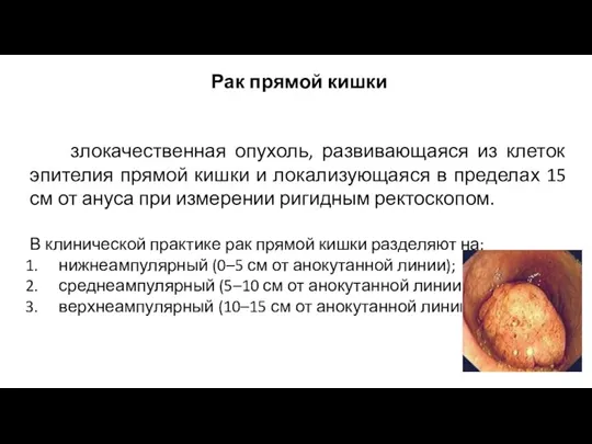 Рак прямой кишки злокачественная опухоль, развивающаяся из клеток эпителия прямой кишки и