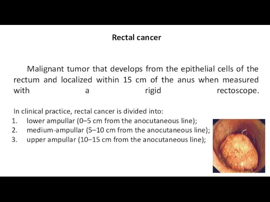 Rectal cancer Malignant tumor that develops from the epithelial cells of the