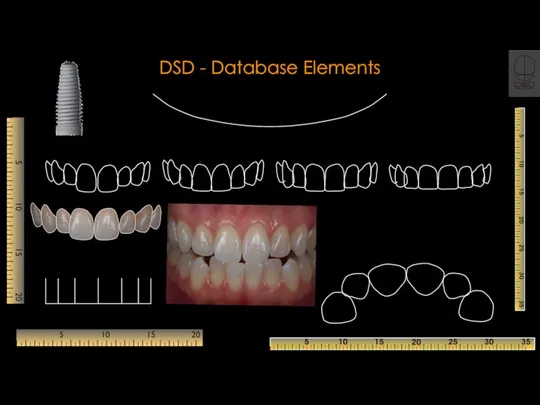 DSD - Database Elements