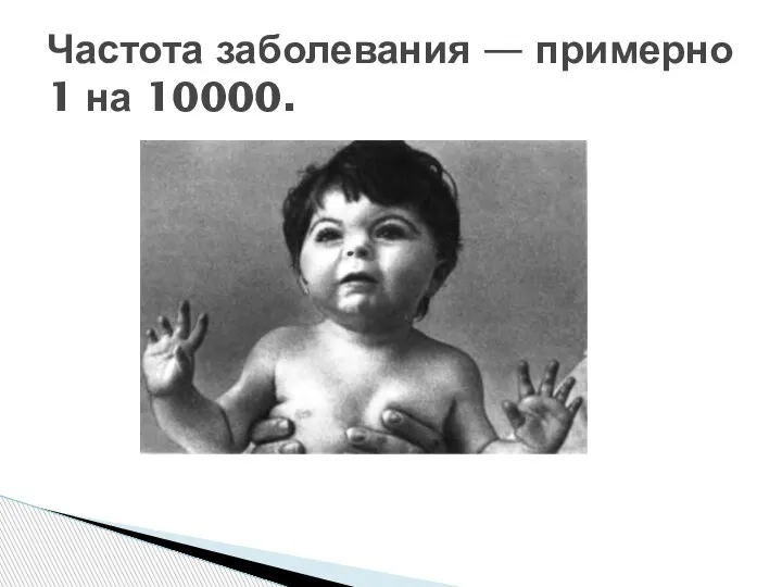 Частота заболевания — примерно 1 на 10000.