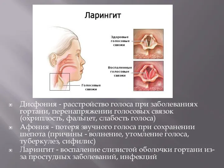 Дисфония - расстройство голоса при заболеваниях гортани, перенапряжении голосовых связок (охриплость, фальцет,