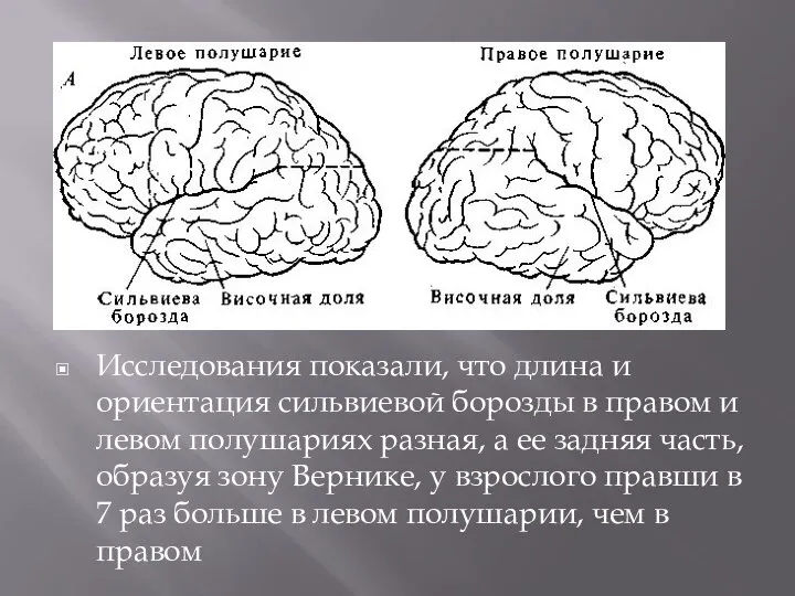 Исследования показали, что длина и ориентация сильвиевой борозды в правом и левом