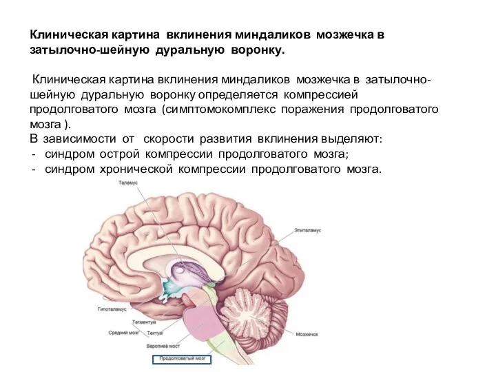 Клиническая картина вклинения миндаликов мозжечка в затылочно-шейную дуральную воронку. Клиническая картина вклинения