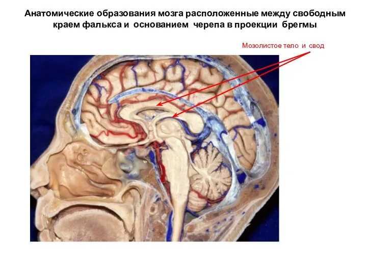 Анатомические образования мозга расположенные между свободным краем фалькса и основанием черепа в