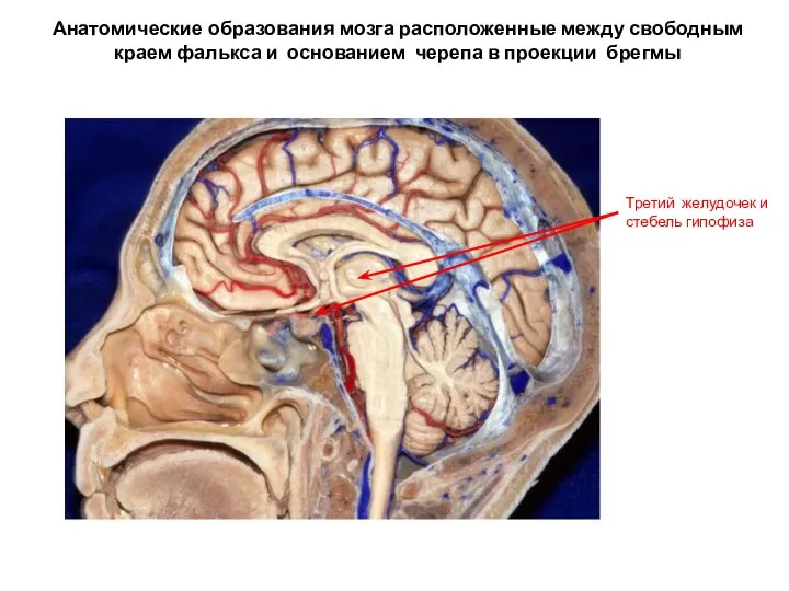 Анатомические образования мозга расположенные между свободным краем фалькса и основанием черепа в