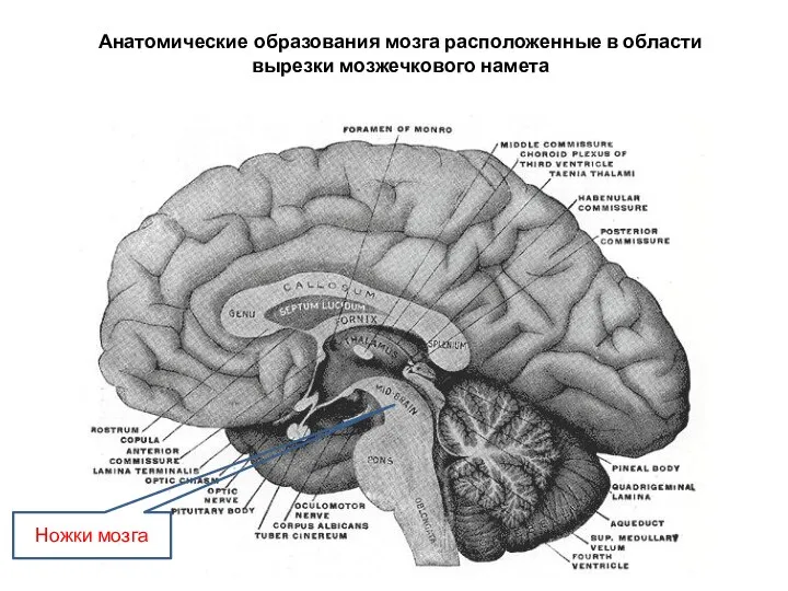 Анатомические образования мозга расположенные в области вырезки мозжечкового намета Ножки мозга