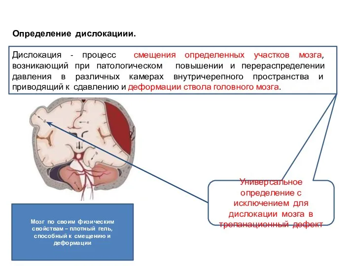 Определение дислокациии. Дислокация - процесс смещения определенных участков мозга, возникающий при патологическом