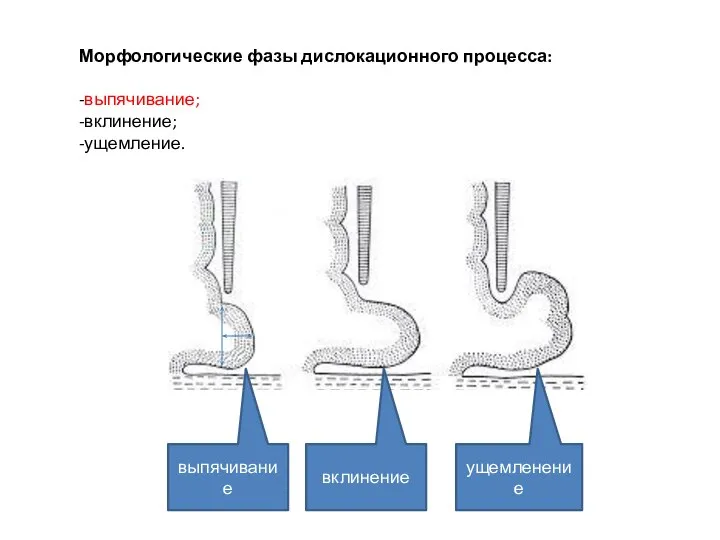 Морфологические фазы дислокационного процесса: -выпячивание; -вклинение; -ущемление. выпячивание вклинение ущемленение