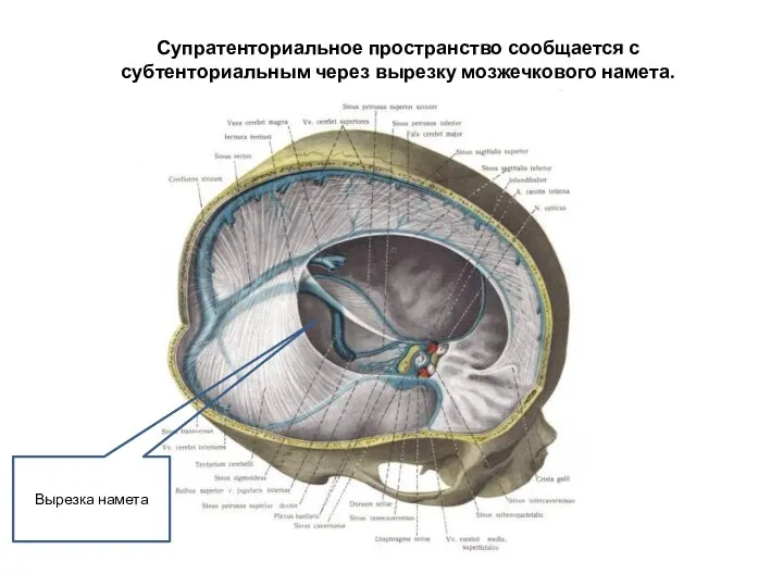 Супратенториальное пространство сообщается с субтенториальным через вырезку мозжечкового намета. Вырезка намета