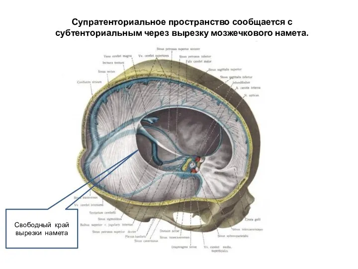 Супратенториальное пространство сообщается с субтенториальным через вырезку мозжечкового намета. Свободный край вырезки намета