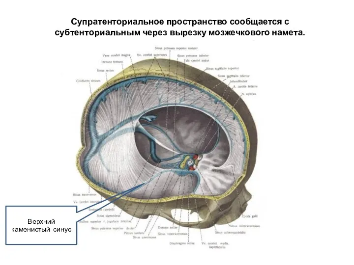 Супратенториальное пространство сообщается с субтенториальным через вырезку мозжечкового намета. Верхний каменистый синус