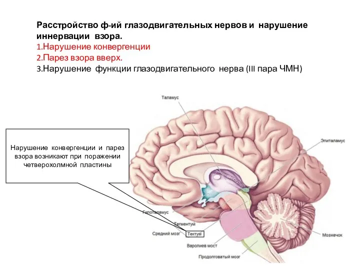 Расстройство ф-ий глазодвигательных нервов и нарушение иннервации взора. 1.Нарушение конвергенции 2.Парез взора