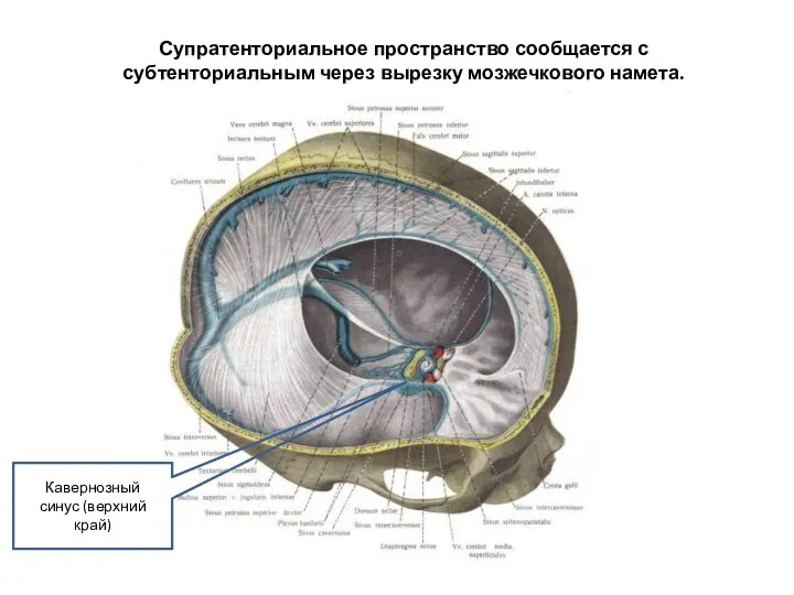 Супратенториальное пространство сообщается с субтенториальным через вырезку мозжечкового намета. Кавернозный синус (верхний край)