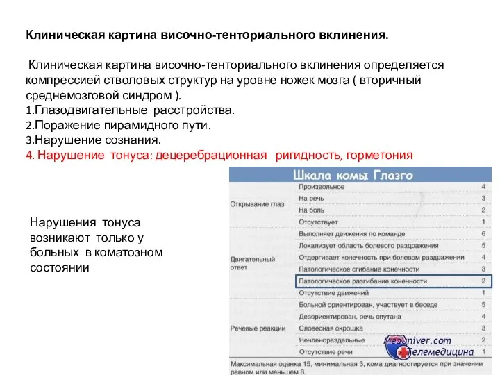 Клиническая картина височно-тенториального вклинения. Клиническая картина височно-тенториального вклинения определяется компрессией стволовых структур