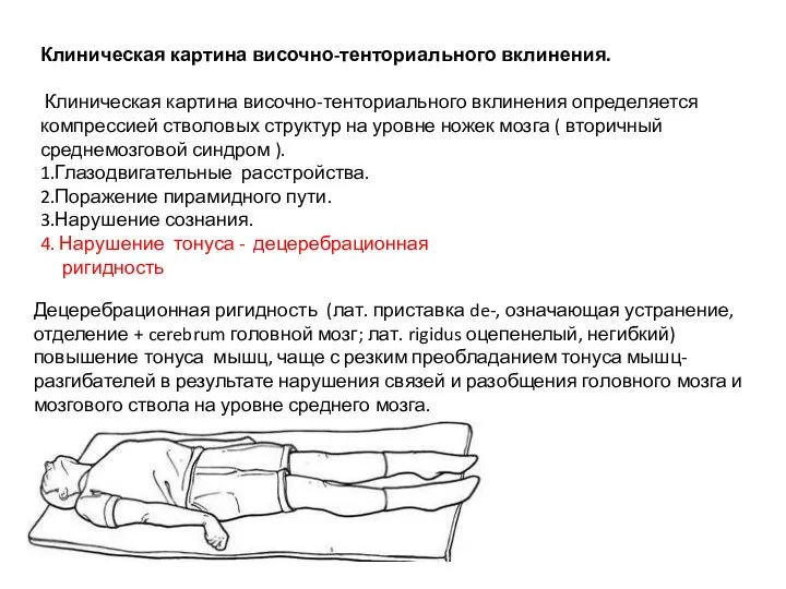 Клиническая картина височно-тенториального вклинения. Клиническая картина височно-тенториального вклинения определяется компрессией стволовых структур