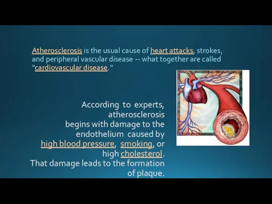 According to experts, atherosclerosis begins with damage to the endothelium caused by