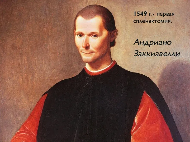 1549 г.- первая спленэктомия. Андриано Заккиавелли