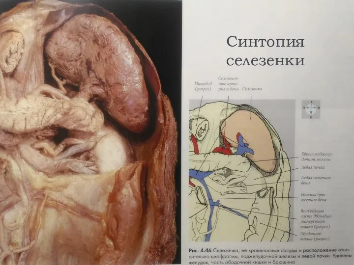 Синтопия селезенки