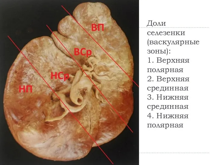 Доли селезенки (васкулярные зоны): 1. Верхняя полярная 2. Верхняя срединная 3. Нижняя срединная 4. Нижняя полярная