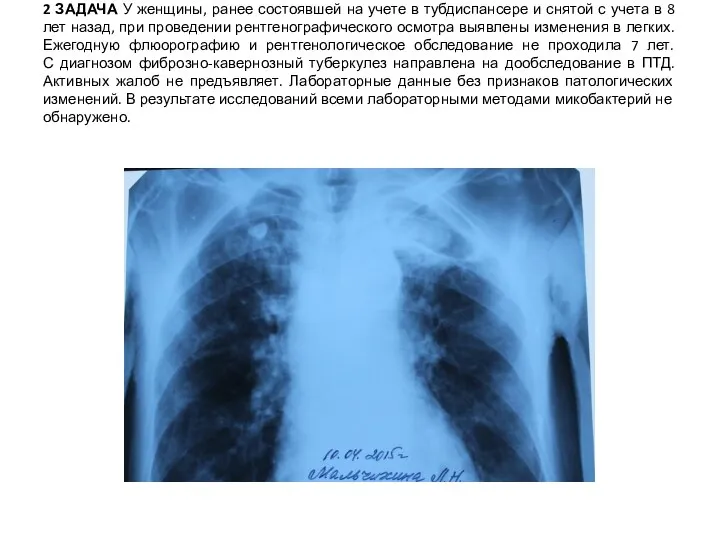 2 ЗАДАЧА У женщины, ранее состоявшей на учете в тубдиспансере и снятой
